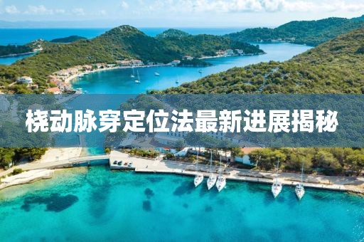 桡动脉穿定位法最新进展揭秘